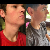 Copy of Before After #DQZ9QTRM