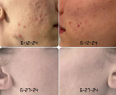 Copy of Before After #DQZ9QTRM