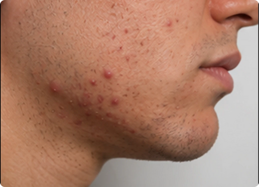 Chin and jawline
