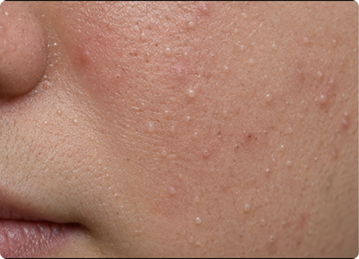 Small white bumps