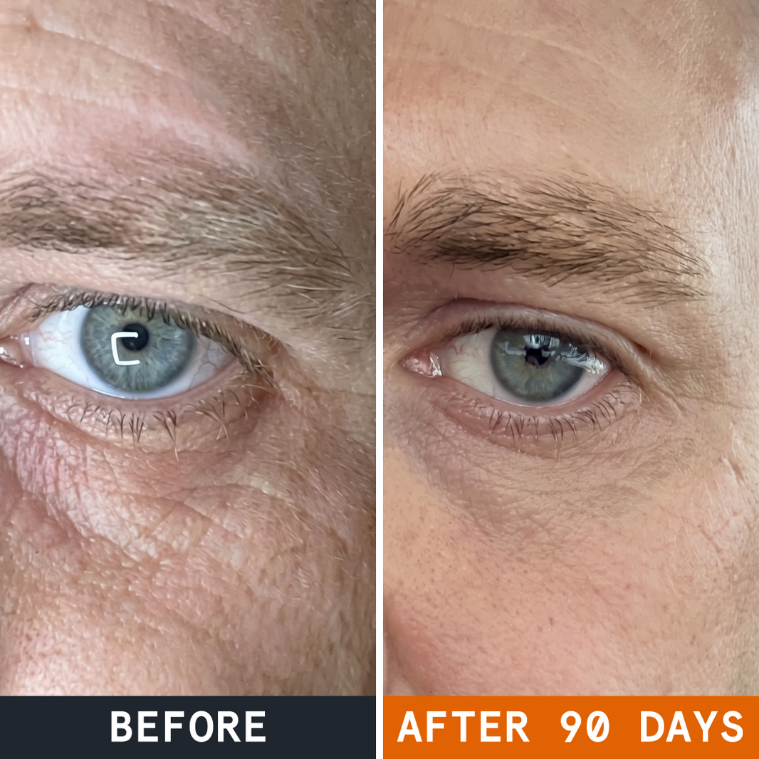 Wrinkle & Dark Circle Warrior Night Balm before and after
